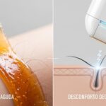 Depilação a Laser Dói Mais que Cera? O Veredito Final para sua Pele